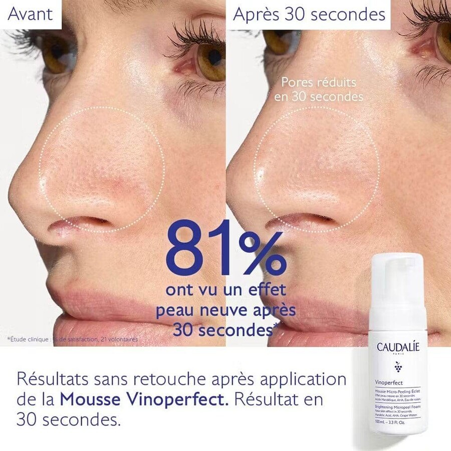 Caudalie Vinoperfect Radiant Micro-Perlating Mousse 50ml Caudalie Vinoperfect Radiant Micro-Perlating Mousse 50ml