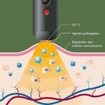 Arkopharma Herpotherm Neo Penna Riscaldante Trattamento dell'Herpes Labialis e delle vesciche da febbre
