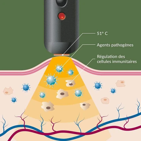 Arkopharma Herpotherm Neo Warming Pen Behandeling van Herpes Labialis en koortsblaren