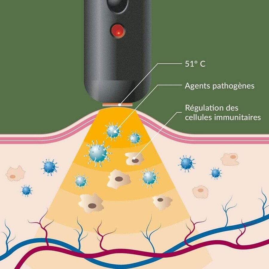 Arkopharma Herpotherm Neo Penna Riscaldante Trattamento dell'Herpes Labialis e delle vesciche da febbre