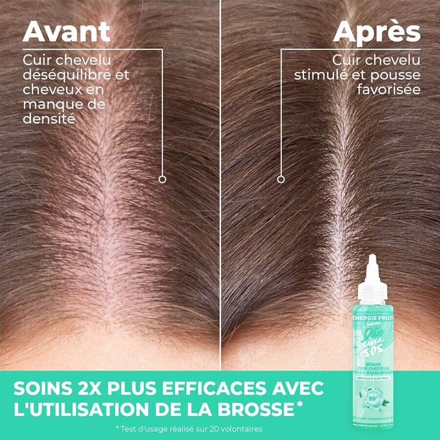 Energie Fruit Brosse Cuir Chevelu Massante Detox Energie Fruit Brosse Cuir Chevelu Massante Detox