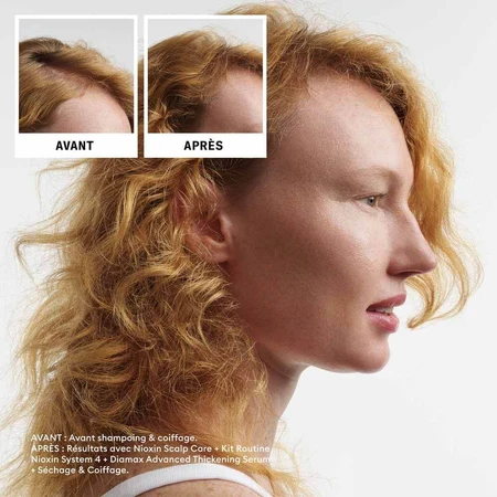 Nioxin System 4 Kit for Colored/Dry/Damaged Hair and Advanced Loss 700ml