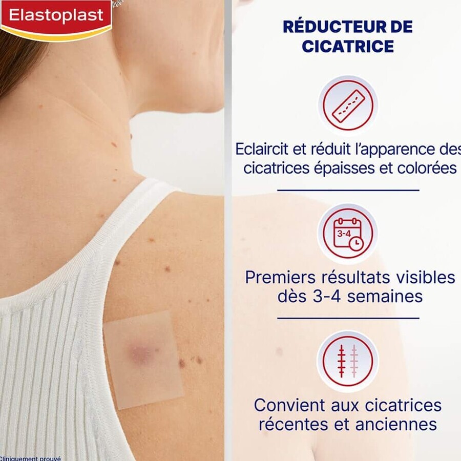 Elastoplast Scar Reducer x21