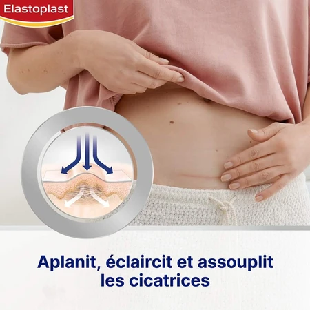 Elastoplast Reductor de Cicatrices x21