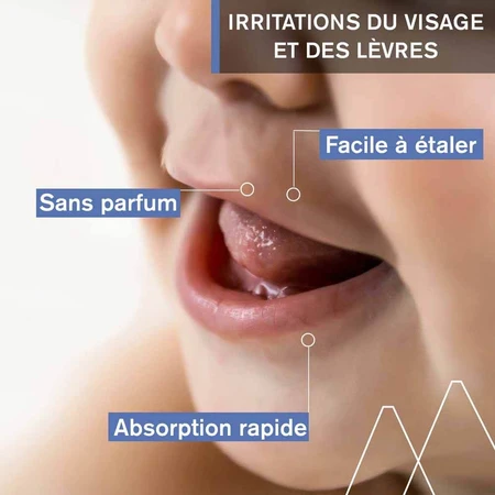 Uriage Bébé Peri-oral Treatment 30ml