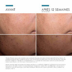 Skinceuticals Discoloration Defense Serum Visage Anti Taches Brunes Et Taches Pigmentaires 30ml