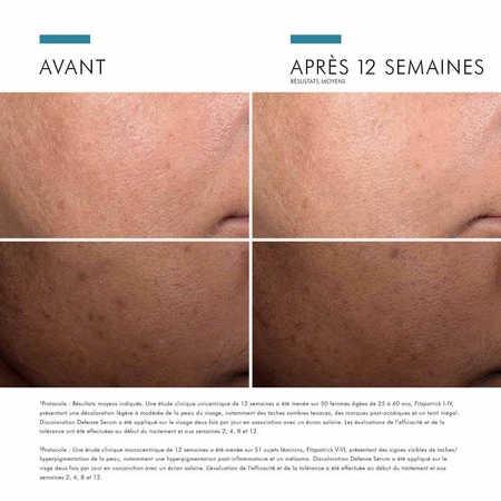 Skinceuticals Discoloration Defense Serum Visage Serum Anti Taches Brunes 30ml