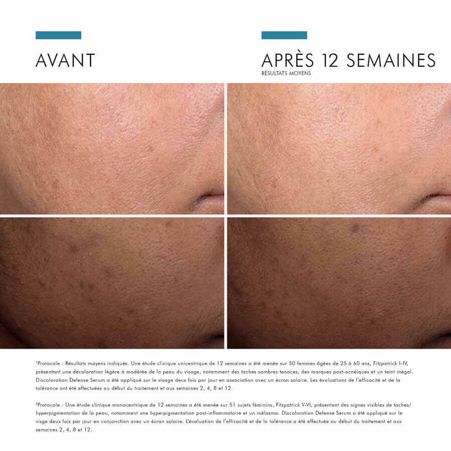 Skinceuticals Discoloration Defense Serum Visage Anti Taches Brunes Et Taches Pigmentaires 30ml Skinceuticals Discoloration Defense Serum Visage Anti Taches Brunes Et Taches Pigmentaires 30ml