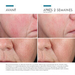 Skinceuticals Phyto Corrective Essence Mist Brume Apaisante Peau Sensible 50ml Skinceuticals Phyto Corrective Essence Mist Brume Apaisante Peau Sensible 50ml