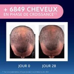 Arkopharma Forcapil Groei Elixir Cheveux Clairsemés 50ml