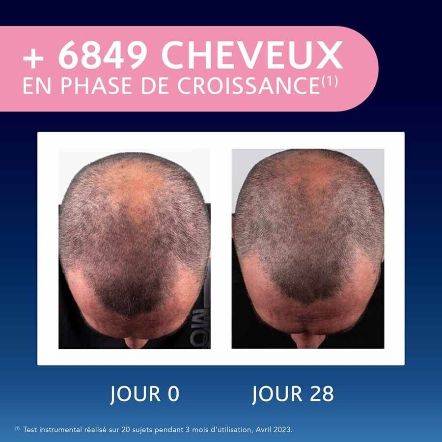 Arkopharma Forcapil Groei Elixir Cheveux Clairsemés 50ml