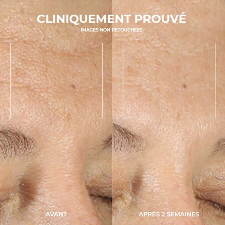Roc Multi-correction Facial Cleansers 177 ml