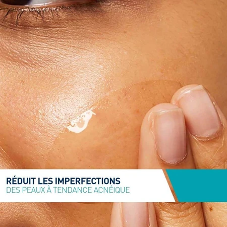 Cerave Gezichtsconcentraat Anti-Imperfection Concentraat Onzuivere en acnegevoelige huid 40ml