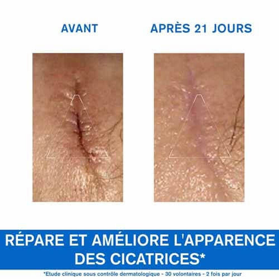 Uriage Bariéderm-Cica Creme Reparatrice Peaux Fragilisees 100ml Uriage Bariéderm-Cica Creme Reparatrice Peaux Fragilisees 100ml