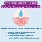 Hyalugel Forte Perio Gel bukkal assainissant Acide Hyaluronique 1.2% 8ml
