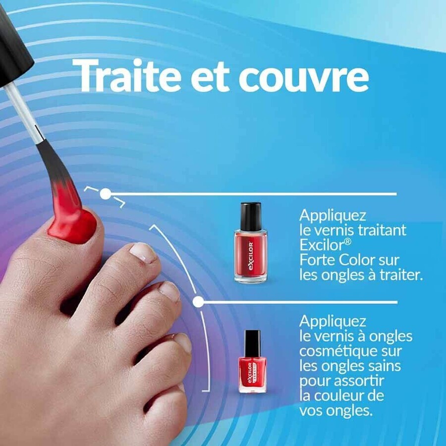 Excilor Trattamento dei funghi delle unghie Colorazione Forte Rosso Corallo 30ml