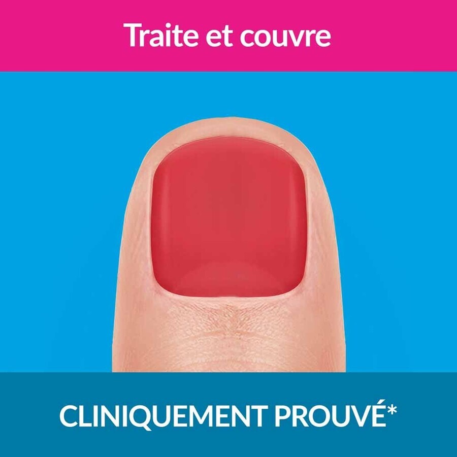 Excilor Trattamento dei funghi delle unghie Colorazione Forte Rosso Corallo 30ml
