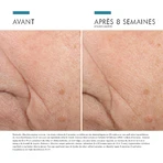Skinceuticals Correct Triple Lipid Restore 2:4:2 48 ml