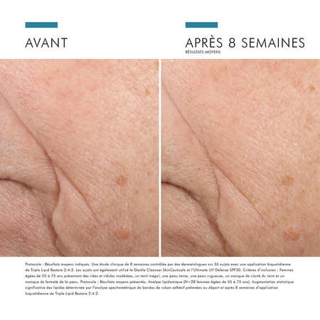 Skinceuticals Correct Triple Lipid Restore 2:4:2 48 ml