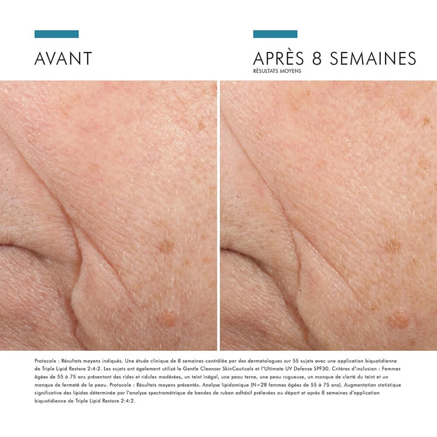 Skinceuticals Correct Triple Lipid Restore 2:4:2 48 ml