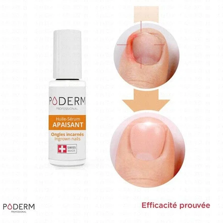 Poderm Serum aceite calmante para uñas sensibles Ongles Incarnés 8ml