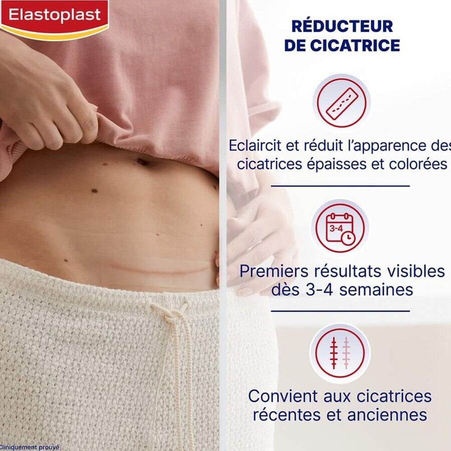 Elastoplast Verband Littekenverminderaar maat XL 21 pleisters