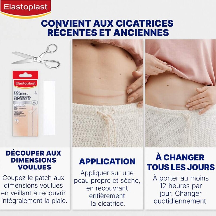 Elastoplast Verband Littekenverminderaar maat XL 21 pleisters
