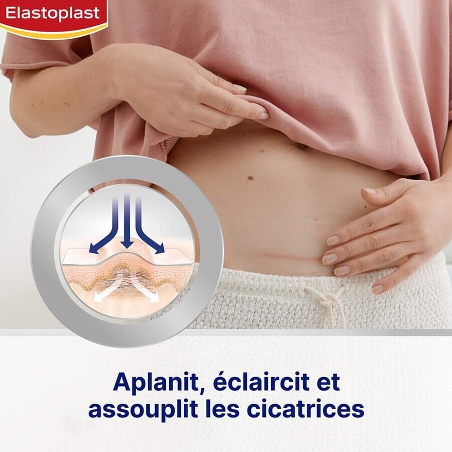 Elastoplast Verband Littekenverminderaar maat XL 21 pleisters
