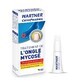 Wartner Traitement De L&#39;ongle Mycose Cryopharma 7ml