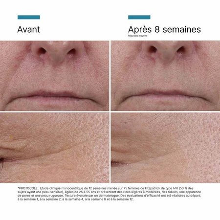 Skinceuticals P-Tiox Sérum Visage Correcteur Anti Rides Avancé Aux Peptides 30ml