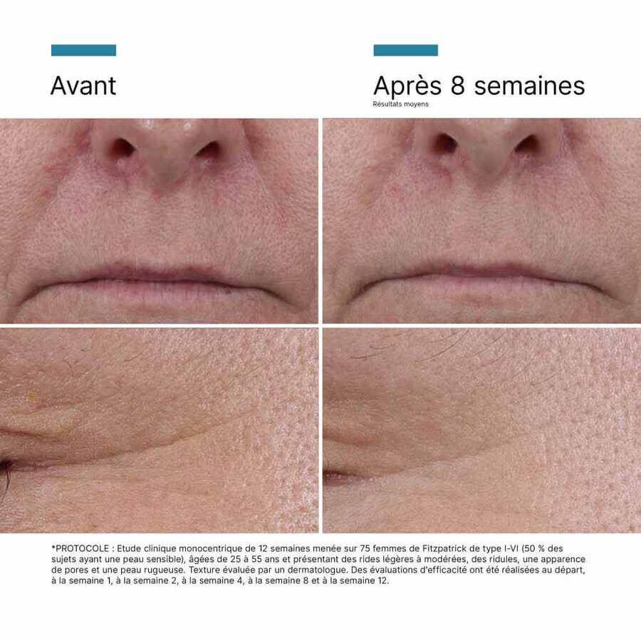 Skinceuticals P-Tiox Sérum Visage Correcteur Anti Rides Avancé Aux Peptides 30ml
