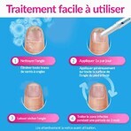 Excilor EASY Traitement Mycose De l’Ongle Déjaunissement 4ml Excilor EASY Traitement Mycose De l’Ongle Déjaunissement 4ml