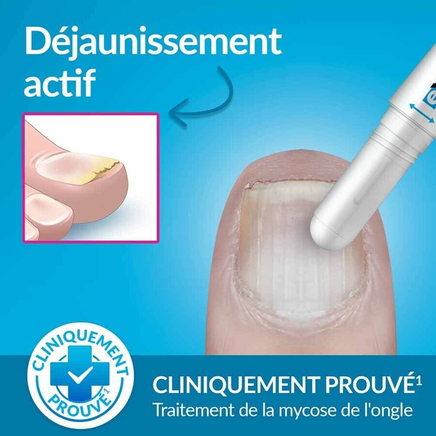 Excilor EASY Traitement Mycose De l’Ongle Déjaunissement 4ml