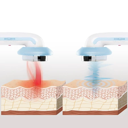CellyMax InnovaGoods Masaje anticelulítico cavitante 3 en 1 con cavitación por ultrasonidos infrarrojos y electroestimulación CellyMax InnovaGoods