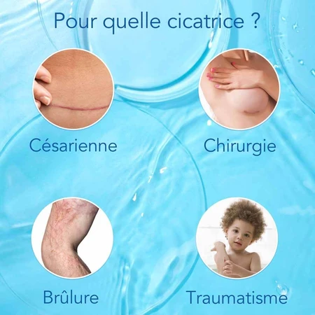 Kelo-cote UV Gel de silicone pour le traitement des cicatrices avec protection solaire SPF30 6g