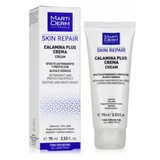 Martiderm Calamine Plus Cream 75ml
