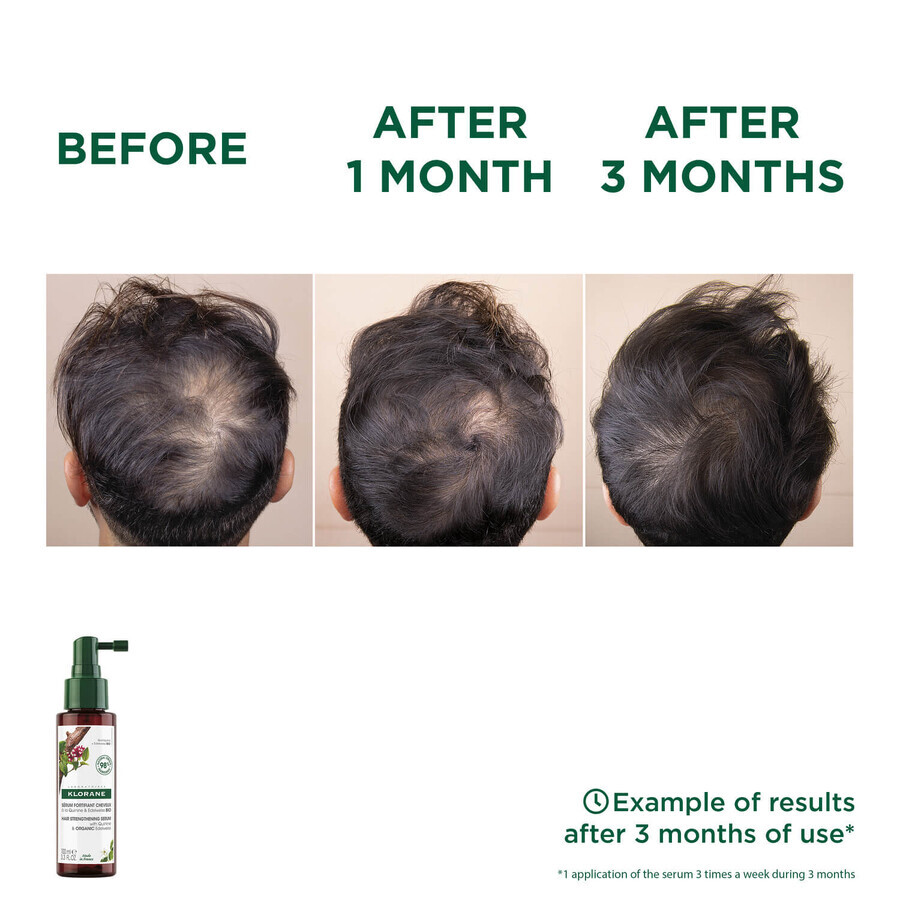 Kit Klorane, champú anticaída y falta de vitalidad, 400 ml + suero anticaída, 100 ml