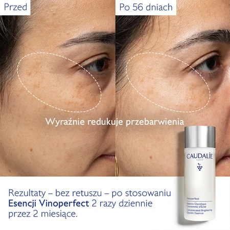 Caudalie Vinoperfect, geconcentreerde glycol-essence om glans te geven, 100 ml