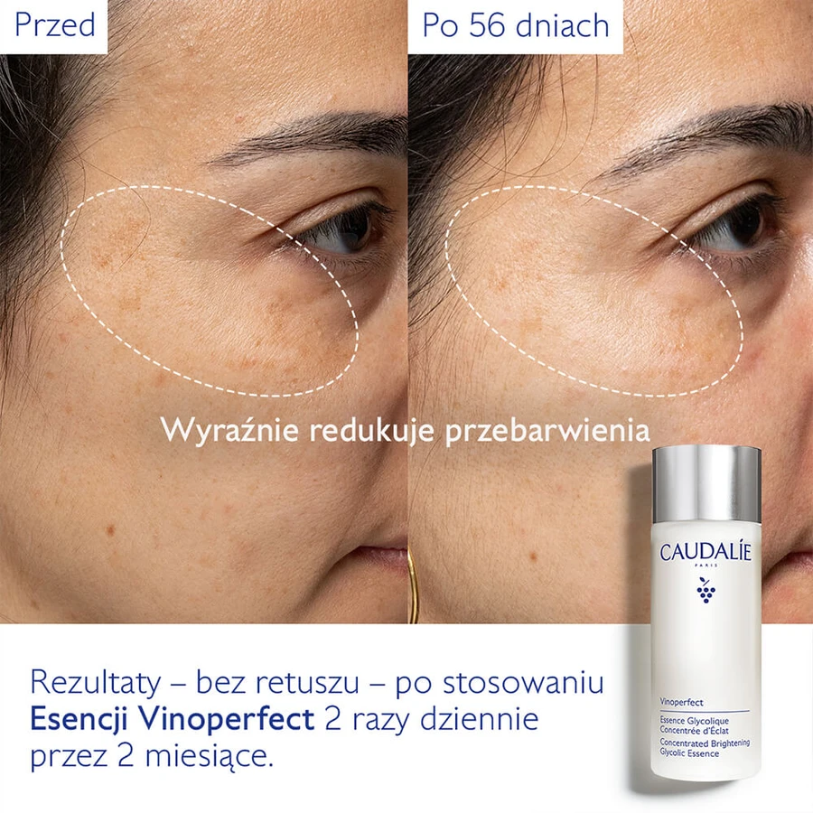 Caudalie Vinoperfect, geconcentreerde glycol-essence om glans te geven, 100 ml