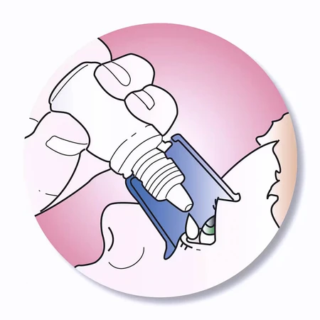 AutoDrop, Augentropfen-Applikator, 1 Stück