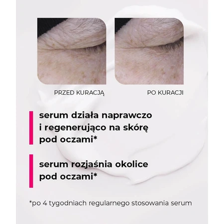 Veoli Botanica 20 Seconds Magic Eye Treatment, liftend en herstellend oog- en ooglid serum, 15 ml