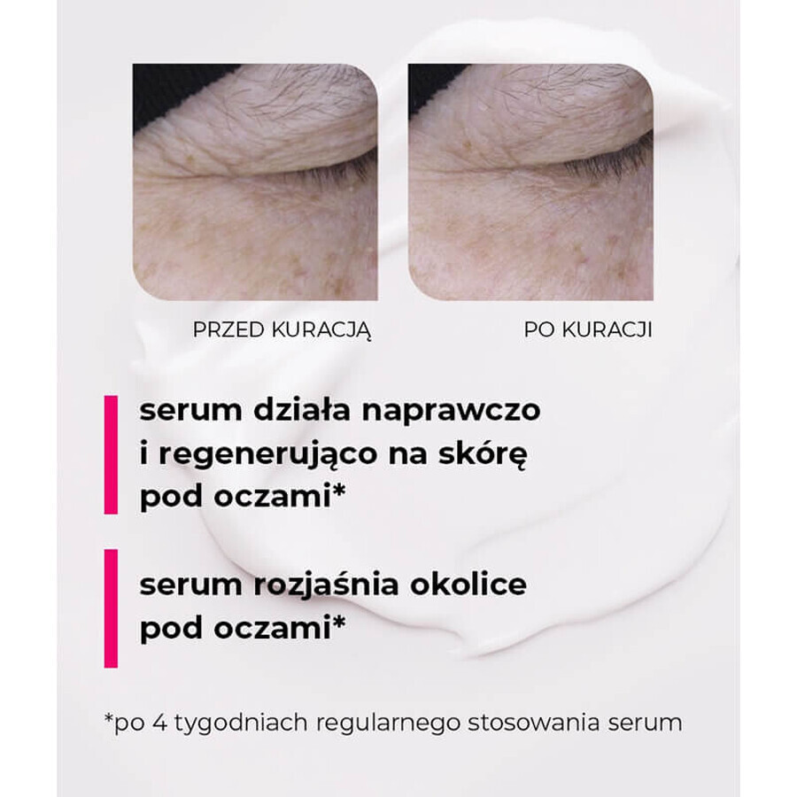 Veoli Botanica 20 Seconds Magic Eye Treatment, ser lifting și reparator pentru ochi și pleoape, 15 ml