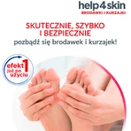 Help4Skin Verrugas, aerosol, 50 ml