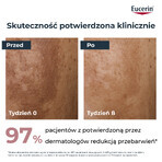 Eucerin Anti-Pigment set, nachtcrème voor onzuiverheden met Thiamidol, 50 ml + gezichtsreinigingsgel met exfoliërende AHA-zuren 2%, 400 ml