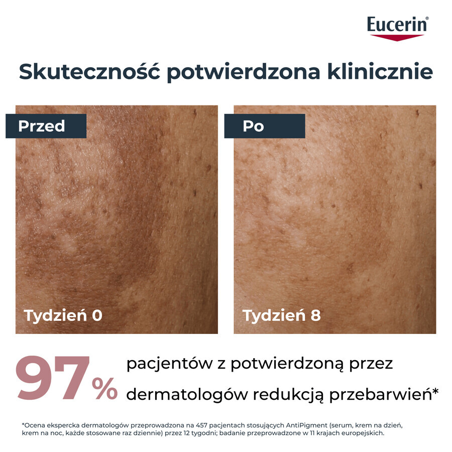 Eucerin Anti-Pigment set, nachtcrème voor onzuiverheden met Thiamidol, 50 ml + gezichtsreinigingsgel met exfoliërende AHA-zuren 2%, 400 ml