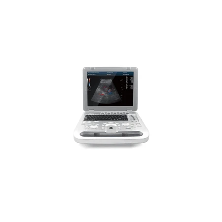 Ecógrafo Contec CMS1700B