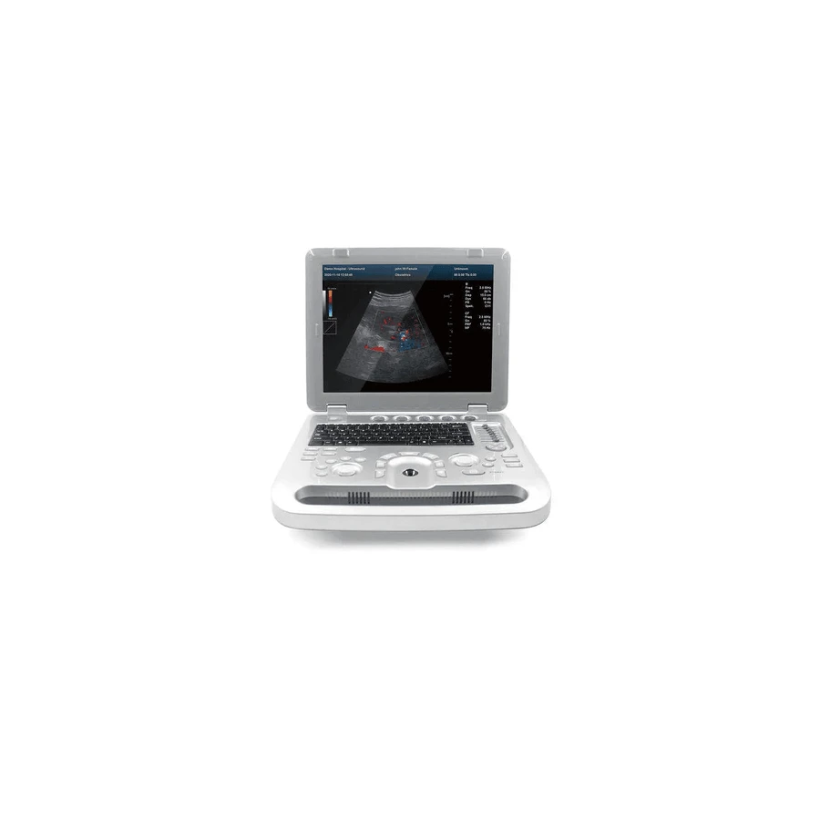 Ecógrafo Contec CMS1700B