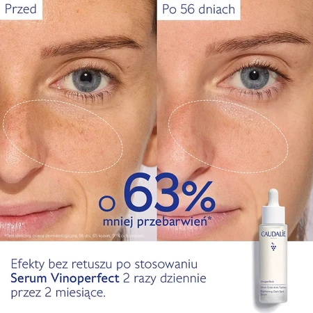 Caudalie Vinoperfect Serum zum Aufhellen von Hautunreinheiten, 50 ml