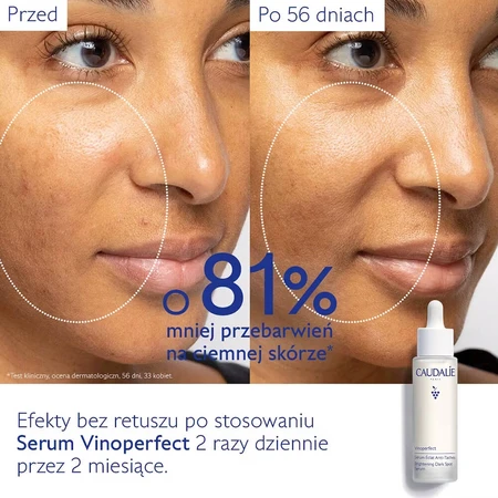 Caudalie Vinoperfect Serum zum Aufhellen von Hautunreinheiten, 50 ml