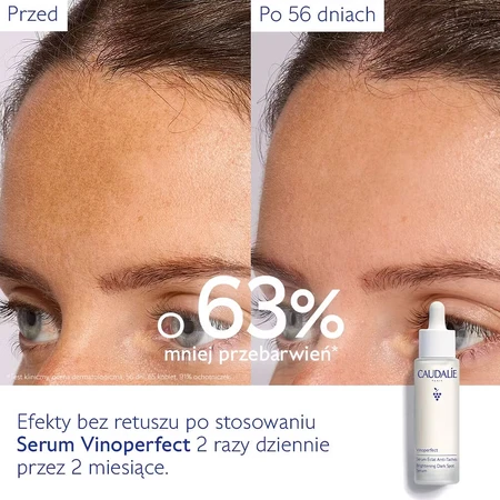 Caudalie Vinoperfect Serum zum Aufhellen von Hautunreinheiten, 50 ml
